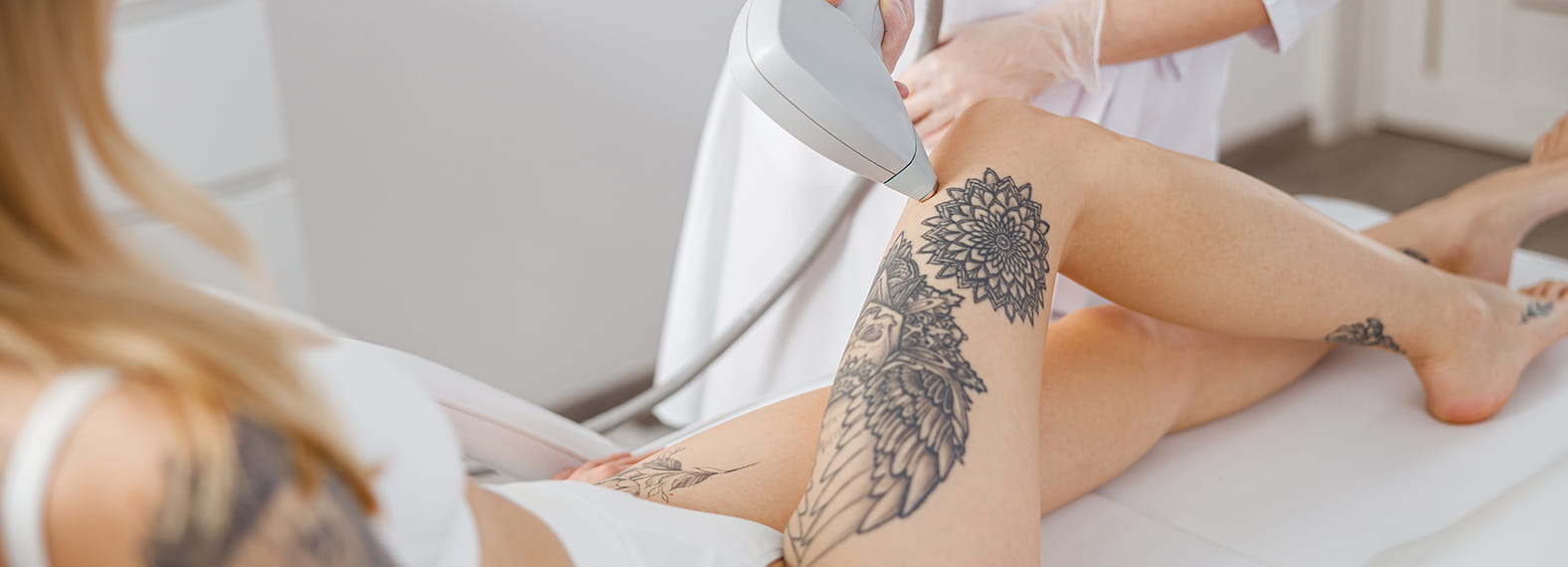 Can You Do Laser Hair Removal Over Tattoos Is It Safe