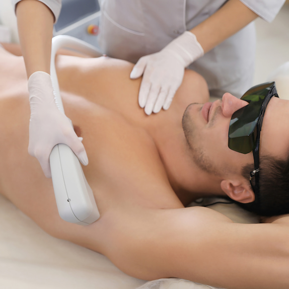 Hair removal by laser | Swiss Derma Clinic
