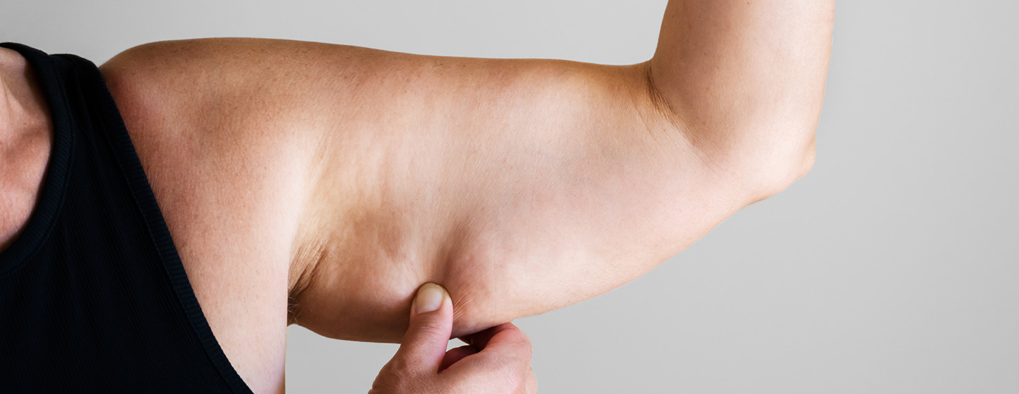 Lipödem behandeln in Zürich