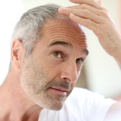 mesotherapie-bei-haarausfall-in-zuerich-mobile